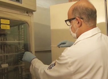 Pesquisadores concluem que doença que deixa urina escura é causada por consumo de peixe 10