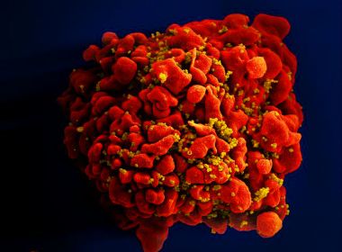 Anticorpo criado nos EUA protege macacos contra infecção por HIV 12