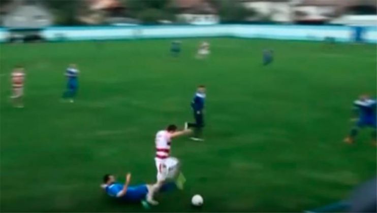 Jogador Perde Testículo Após Disputa De Bola; Veja O Vídeo Jogador Perde Testículo Após Disputa De Bola; Veja O Vídeo 10