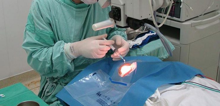 Hospital das Clínicas realizará no próximo dia 23, o 6º mutirão de cirurgia de Catarata 4