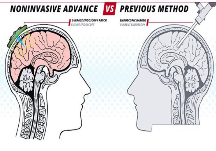 Novo ultrassom faz imagens internas do corpo e dispensa endoscopia 7