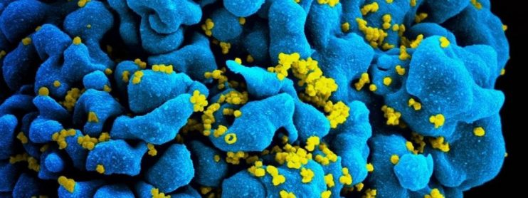 HIV: descoberta segunda mutação em gene que torna células imunes ao vírus 4