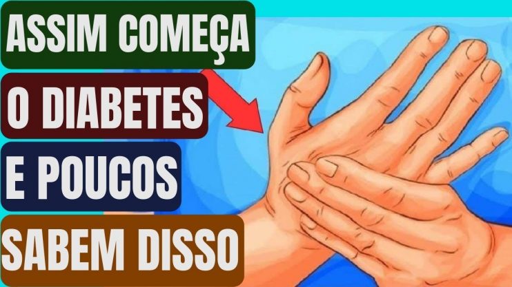 Se Você Tiver Algum Desses Sintomas Pode Ser Início de Diabetes E Você Nem Sabe. Fique Atento! 7