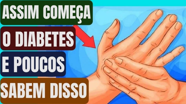 Se Você Tiver Algum Desses Sintomas Pode Ser Início de Diabetes E Você Nem Sabe. Fique Atento! 10