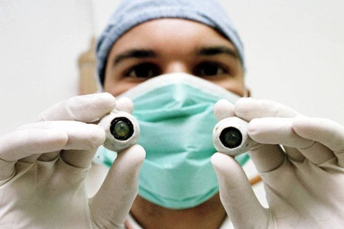 Primeiro transplante de córnea artificial do mundo restaura visão de homem cego 6
