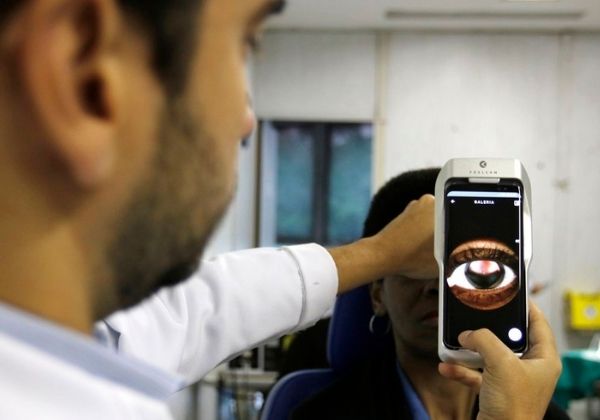 Forma grave do coronavírus pode causar lesões irreversíveis nos olhos de pacientes 9