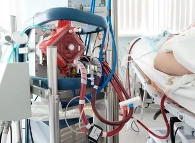 Procedimento raro e de alto custo, ECMO não está disponível para pacientes do SUS na Bahia 4