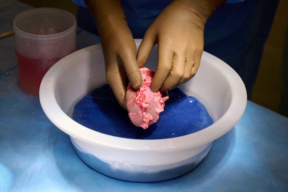 Em feito inédito, cirurgiões dos EUA testam com sucesso transplante de rim de porco em humano 1