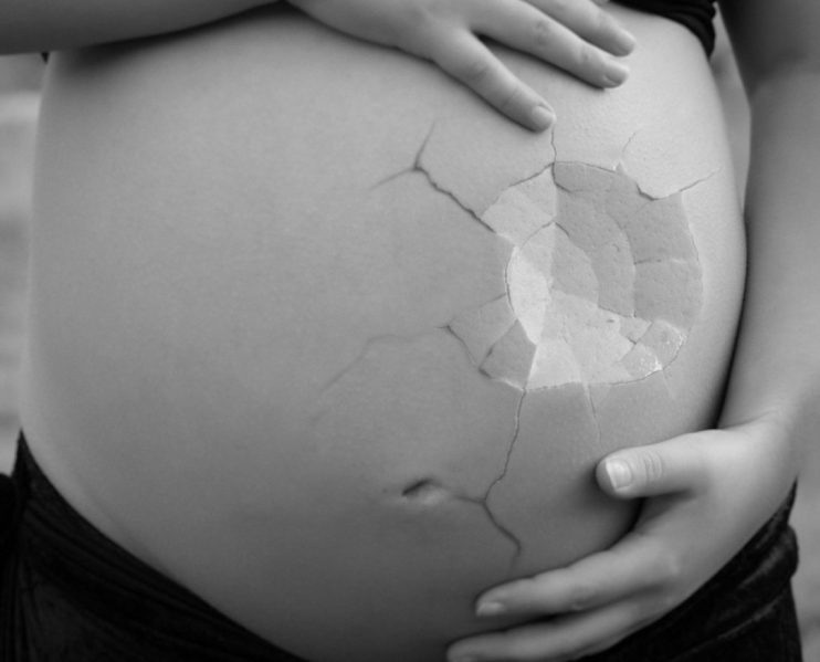 Falsa grávida é presa com eletrônicos contrabandeados na barriga; veja flagrante 13
