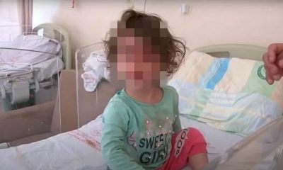Menina de 2 anos dá dentada e mata cobra que a atacou: 'Estava brincando' 26