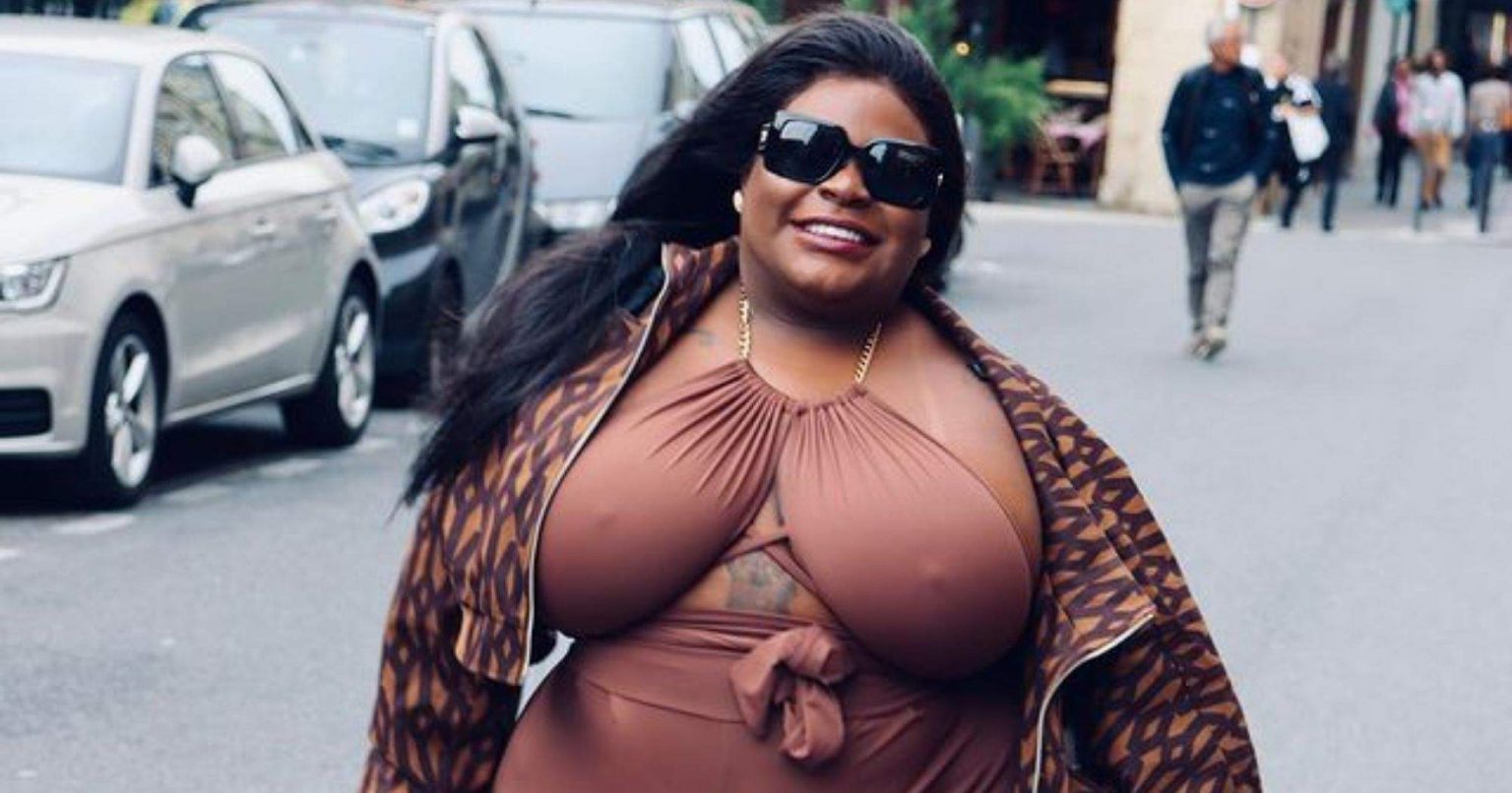 Após separação, Jojo Todynho revela que vai fazer cirurgia bariátrica Após separação, Jojo Todynho revela que vai fazer cirurgia bariátrica 5