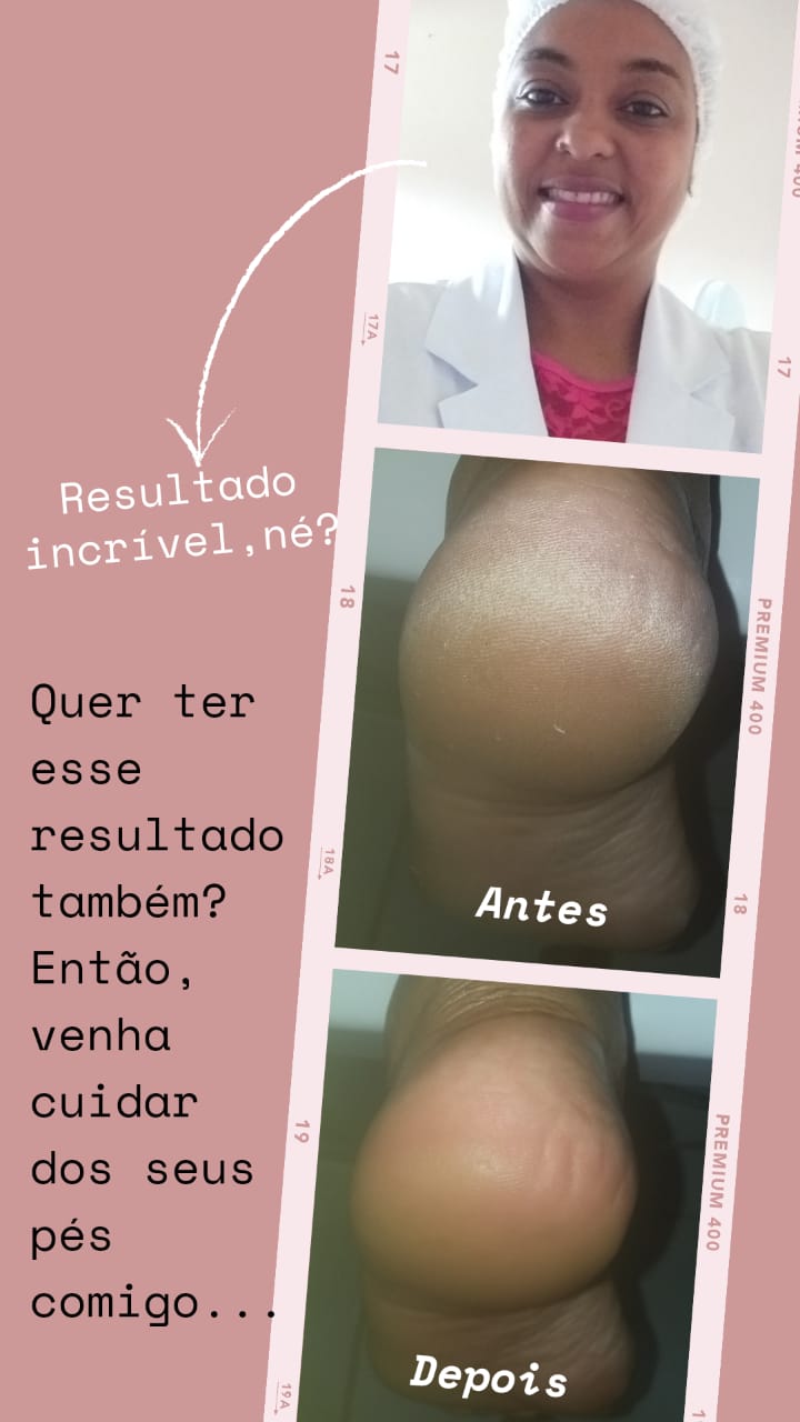 Atenção!!! Homens e Mulheres vocês sabiam que os pés deveriam ser um dos principais pontos de atenção em se tratando do bem-estar? 8