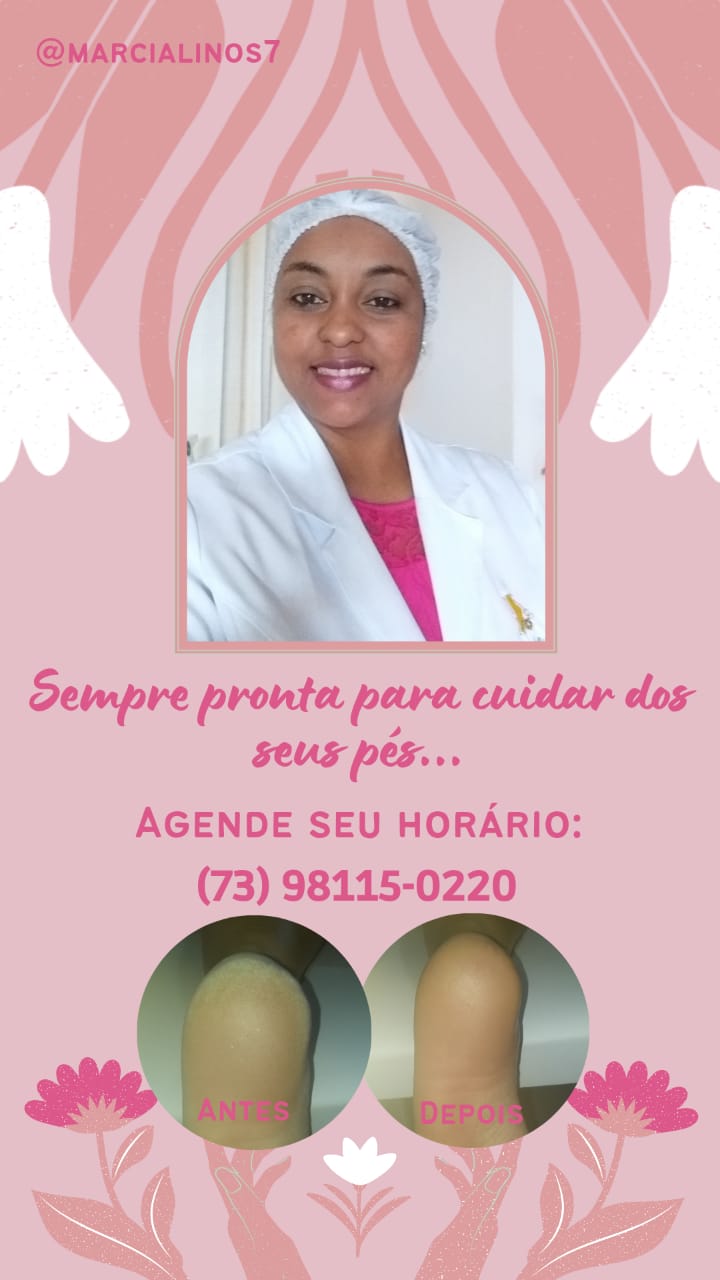 Atenção!!! Homens e Mulheres vocês sabiam que os pés deveriam ser um dos principais pontos de atenção em se tratando do bem-estar? 5