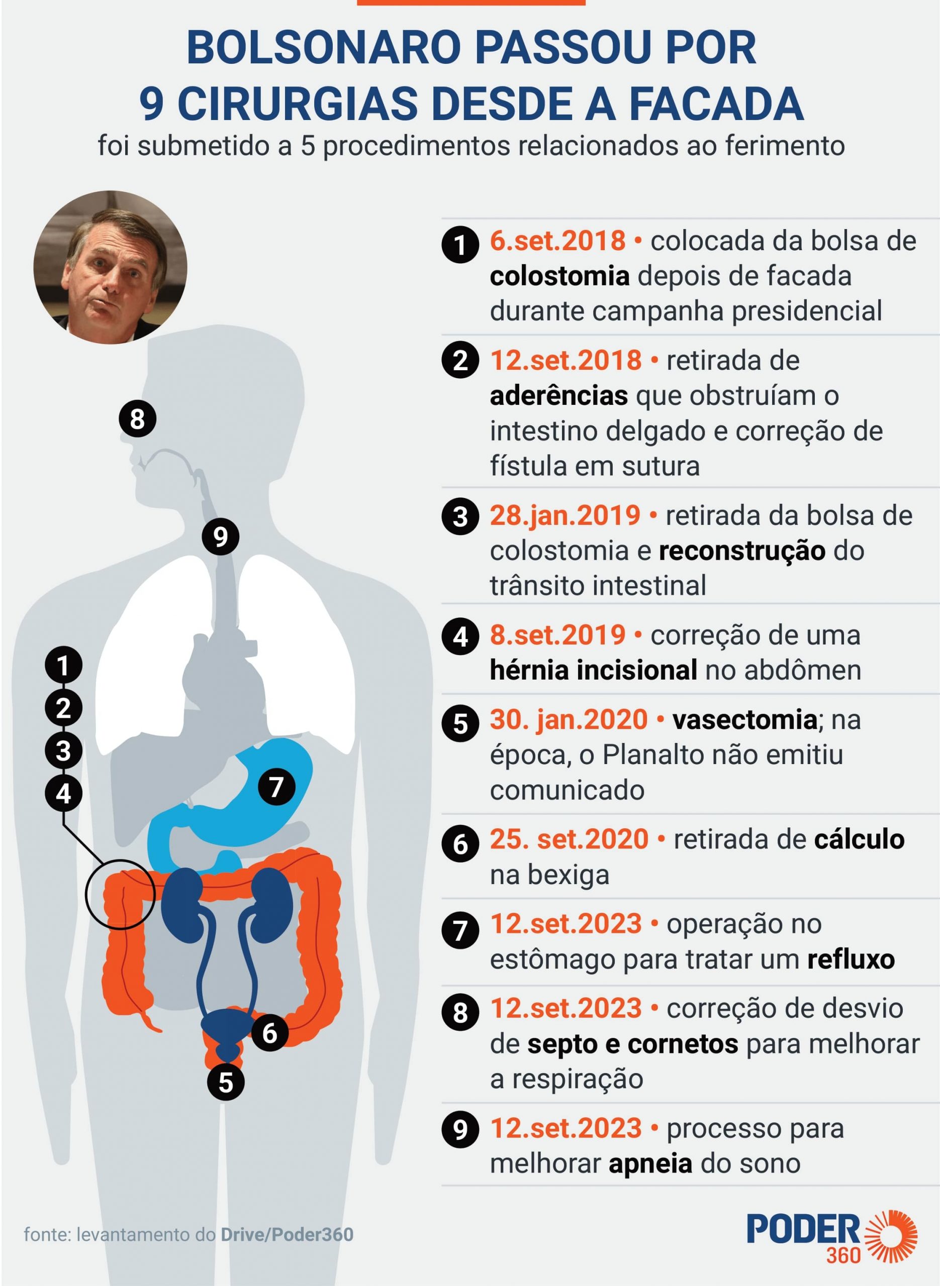 “Mais uma etapa vencida”, diz Bolsonaro sobre cirurgias 4
