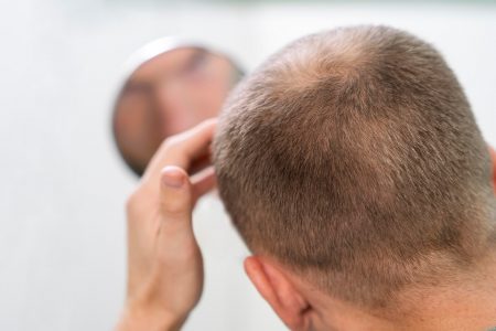 Diabete, cigarro, estresse e outros fatores podem causar queda de cabelo 4