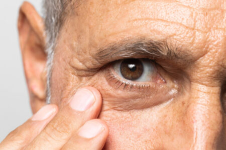 Retinopatia diabética, complicação do diabetes que pode causar cegueira 7