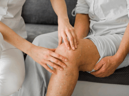 Estou com varizes. E agora? 11