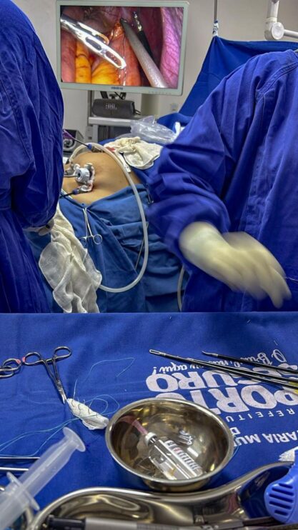 BARIÁTRICAS | Mais de 30 procedimentos em dois dias marcam avanço histórico na saúde de Porto Seguro 17