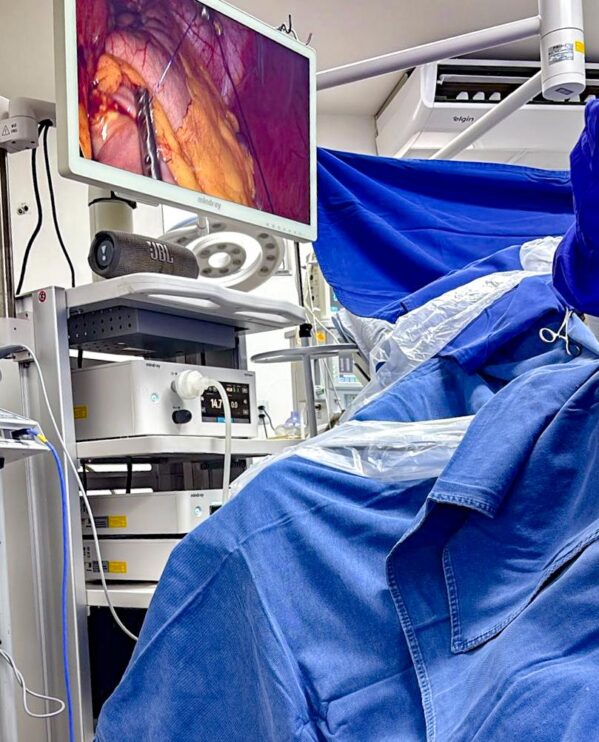 BARIÁTRICAS | Mais de 30 procedimentos em dois dias marcam avanço histórico na saúde de Porto Seguro 14