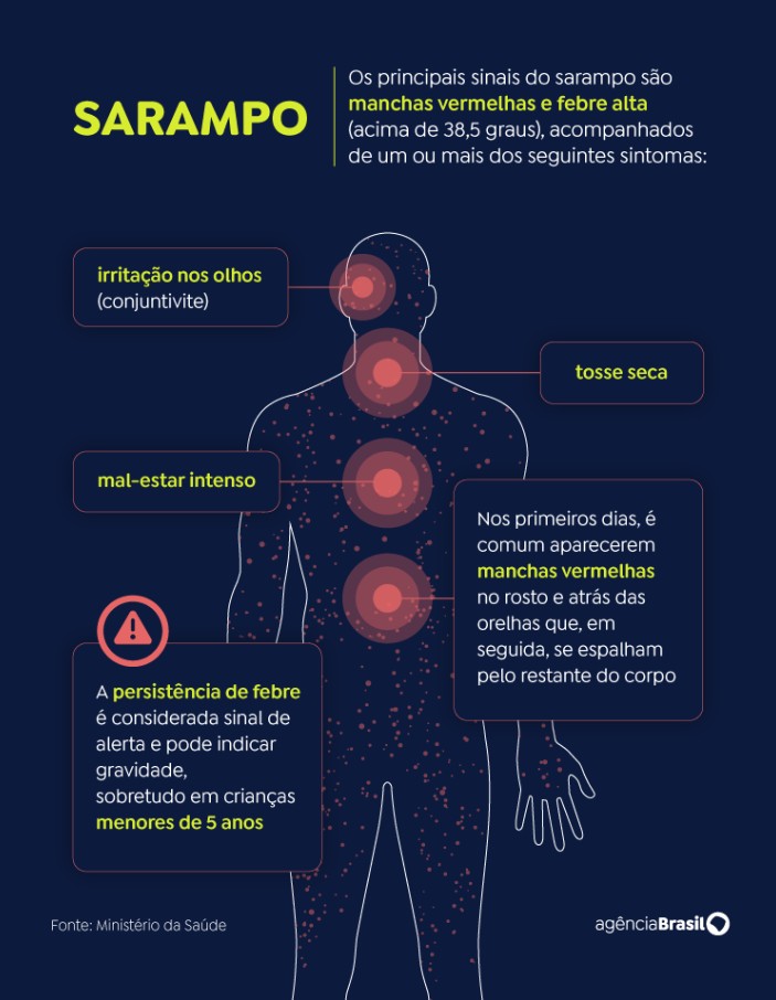 Sarampo: entenda sintomas, riscos e quando se vacinar 5