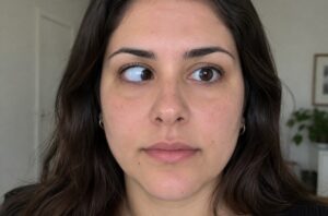Estrabismo: veja como o uso de telas pode influenciar a saúde dos olhos Estrabismo: veja como o uso de telas pode influenciar a saúde dos olhos 1